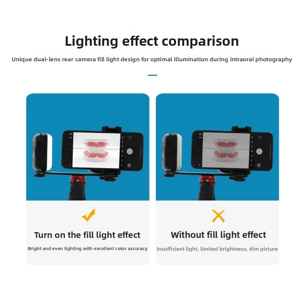 Dental Photography Light, Blue – обзор и цена Photography Lighting Portable