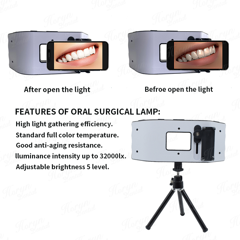 Dental Flash Light Photography – обзор и цена Photography Lighting With Flash